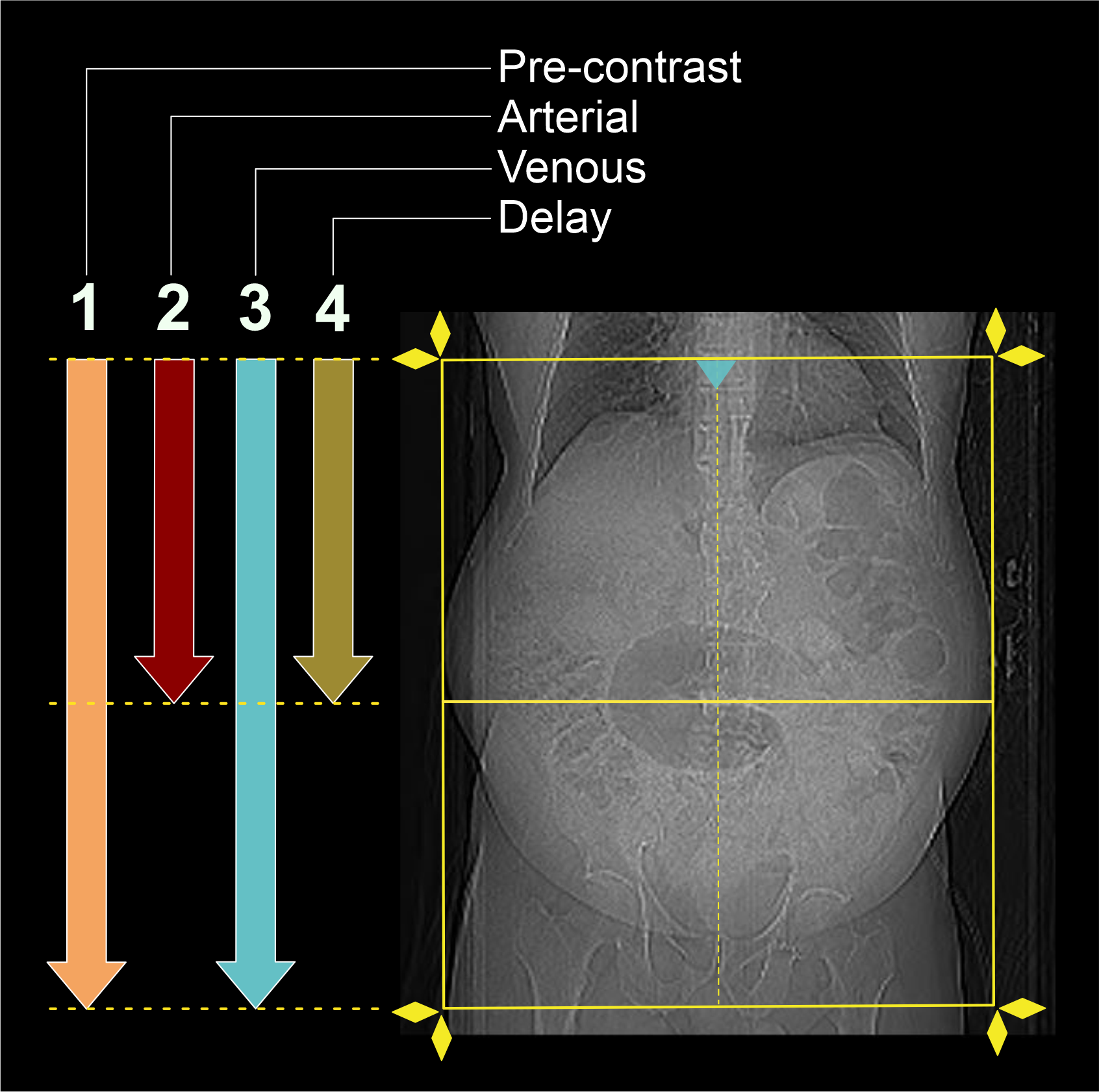 Demonstrates scan slab and S & V slice planning for CT multiphase abdomen.