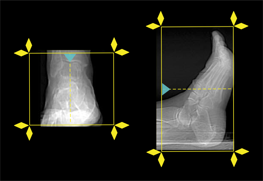 Demonstrates scan slab planning for CT foot scan.