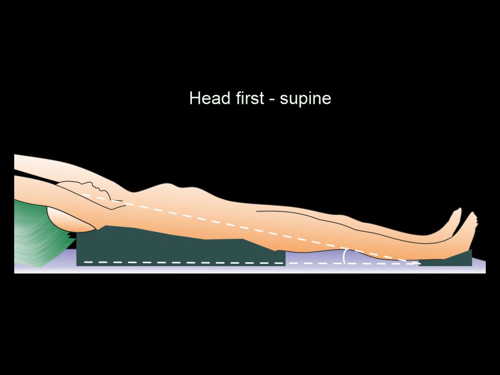 Demonstrates patient positioning for CT venogram of lower limbs.
