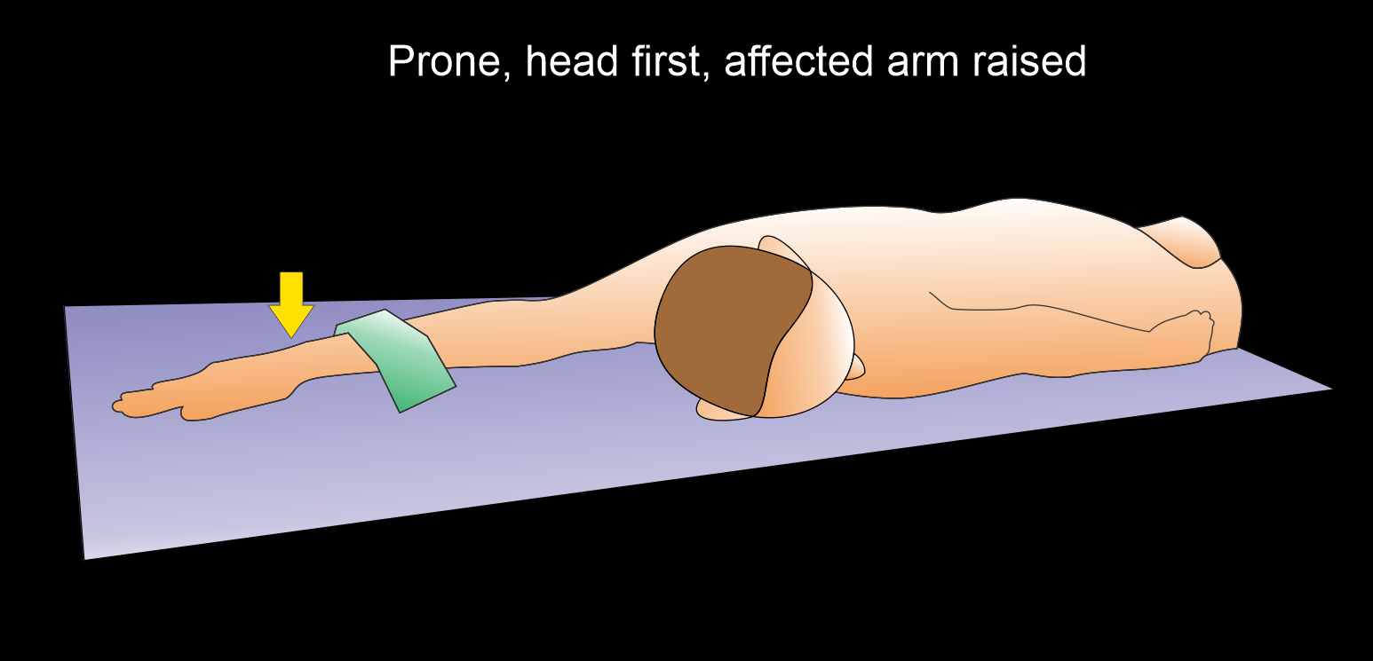 Illustration demonstrates patient positioning for CT wrist scan - positioned in prone, head first and raised affected arm.
