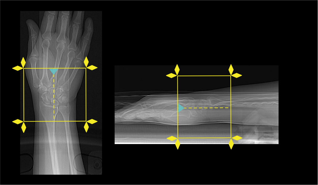 Demonstrates scan slab planning for CT wrist joint scan.