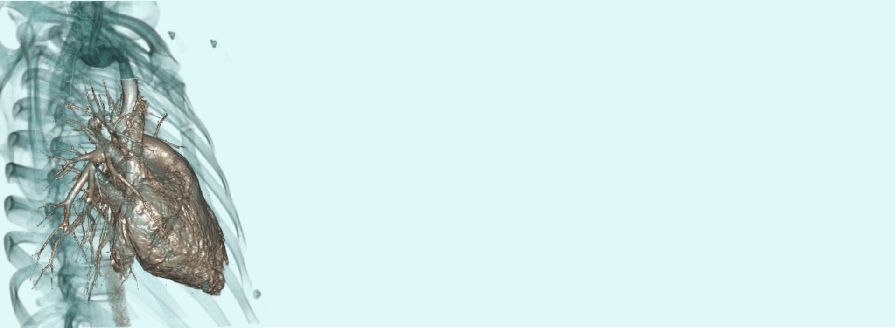 CT Pulmonary angiogram shows the heart along with pulmonary arteries